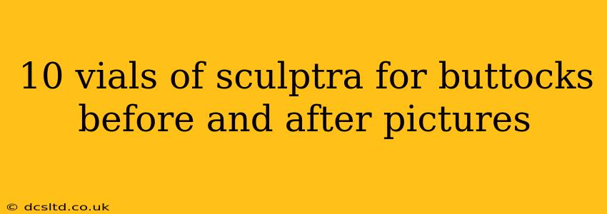 10 vials of sculptra for buttocks before and after pictures