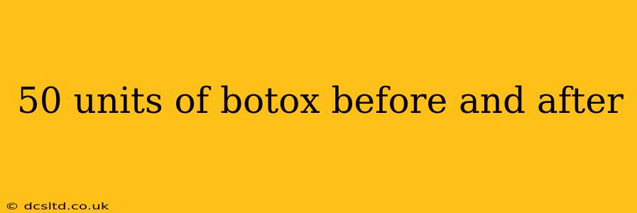 50 units of botox before and after