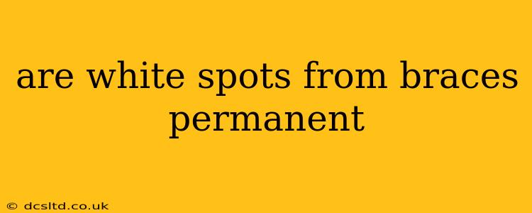 are white spots from braces permanent