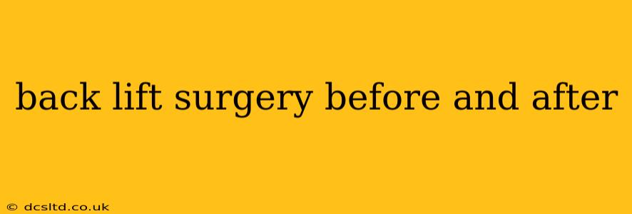 back lift surgery before and after