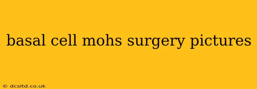 basal cell mohs surgery pictures