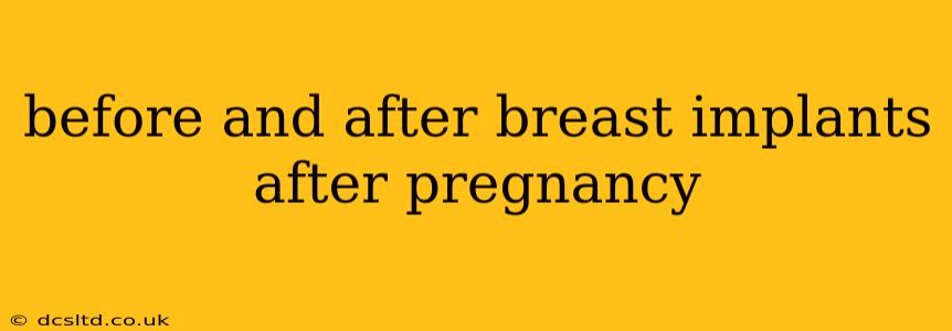 before and after breast implants after pregnancy
