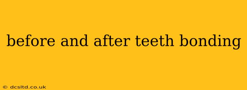 before and after teeth bonding