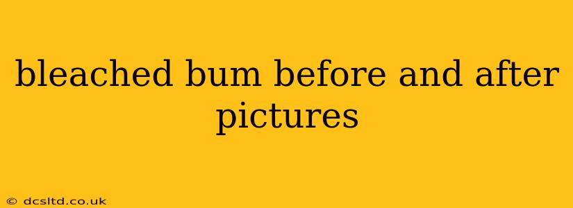 bleached bum before and after pictures