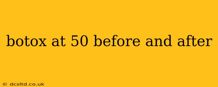 botox at 50 before and after