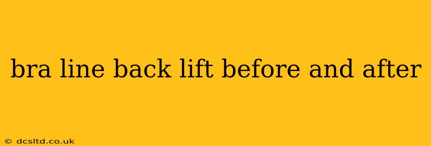 bra line back lift before and after