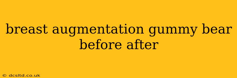 breast augmentation gummy bear before after