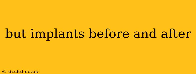 but implants before and after