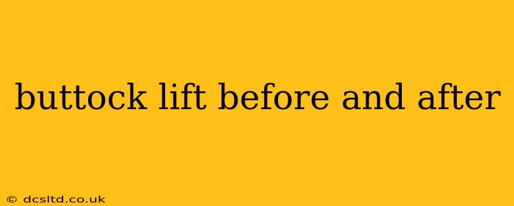 buttock lift before and after