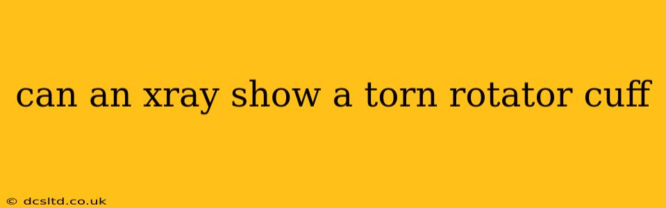 can an xray show a torn rotator cuff