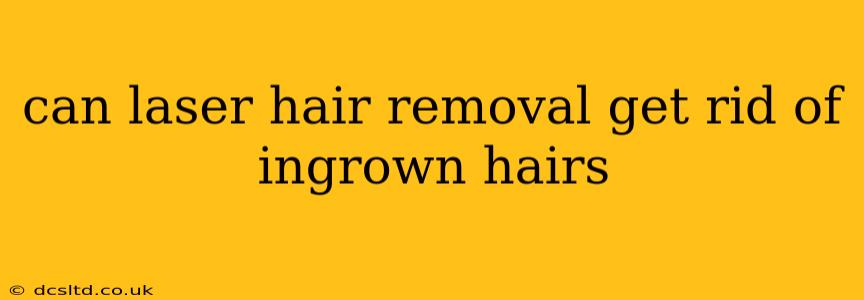 can laser hair removal get rid of ingrown hairs