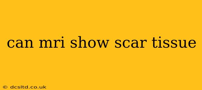 can mri show scar tissue