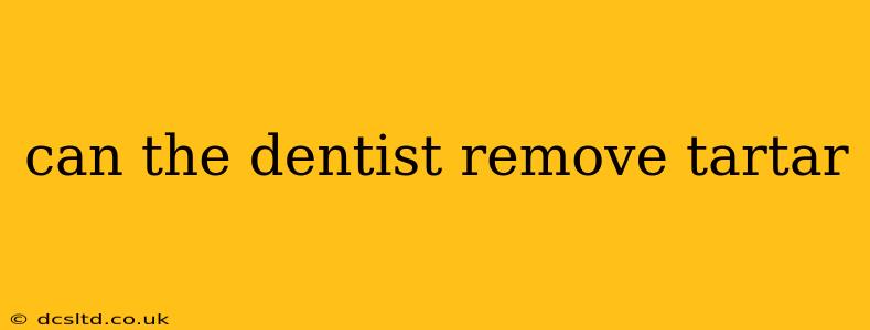 can the dentist remove tartar