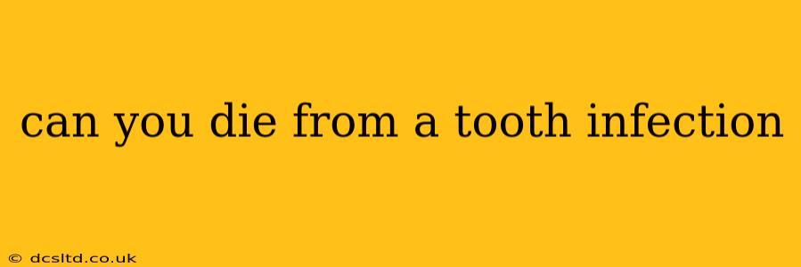 can you die from a tooth infection