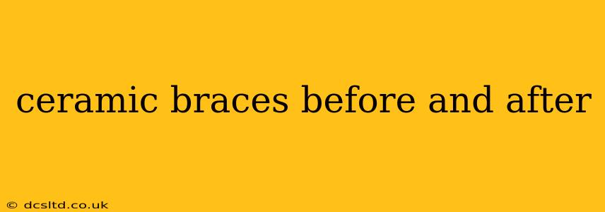 ceramic braces before and after