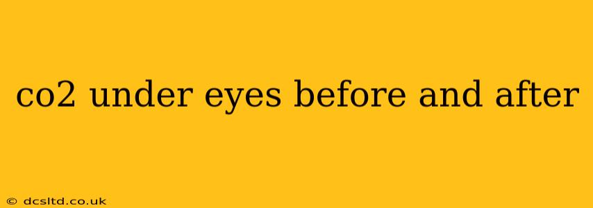 co2 under eyes before and after