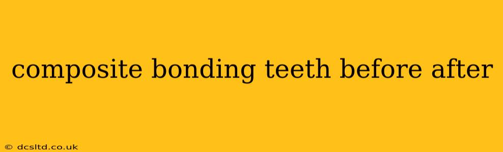 composite bonding teeth before after