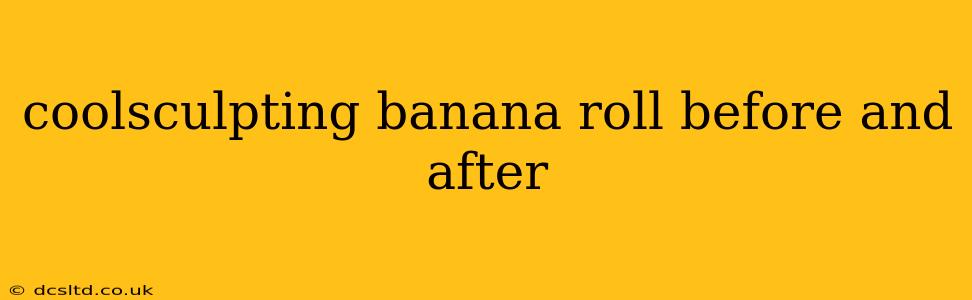 coolsculpting banana roll before and after