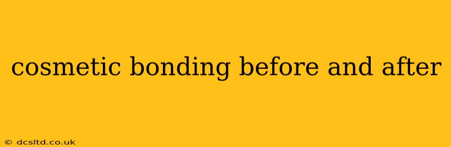 cosmetic bonding before and after