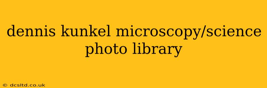 dennis kunkel microscopy/science photo library