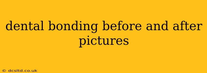 dental bonding before and after pictures