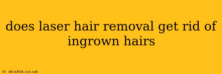does laser hair removal get rid of ingrown hairs