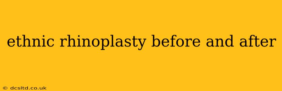 ethnic rhinoplasty before and after