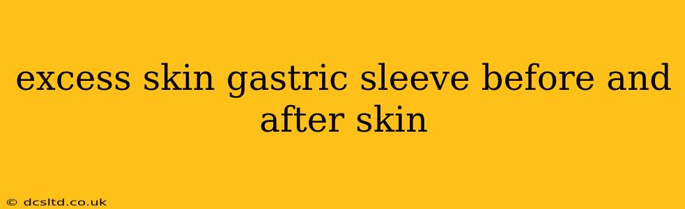 excess skin gastric sleeve before and after skin