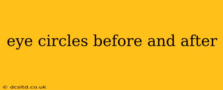 eye circles before and after