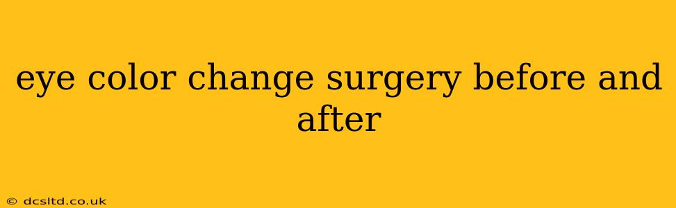 eye color change surgery before and after
