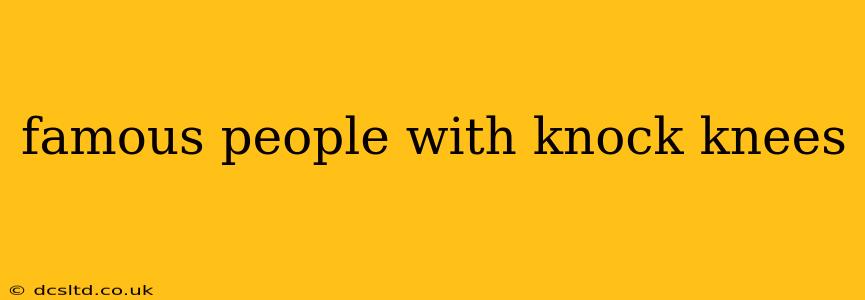 famous people with knock knees