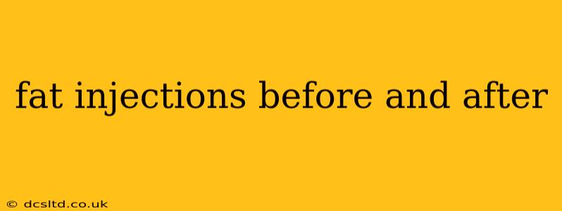 fat injections before and after
