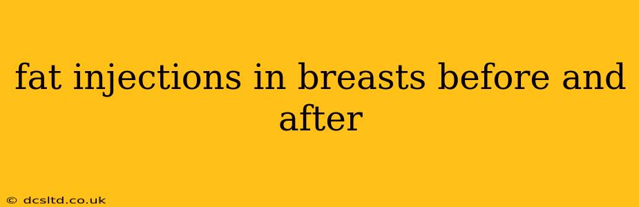 fat injections in breasts before and after