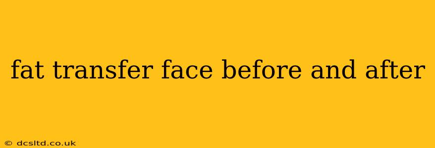 fat transfer face before and after