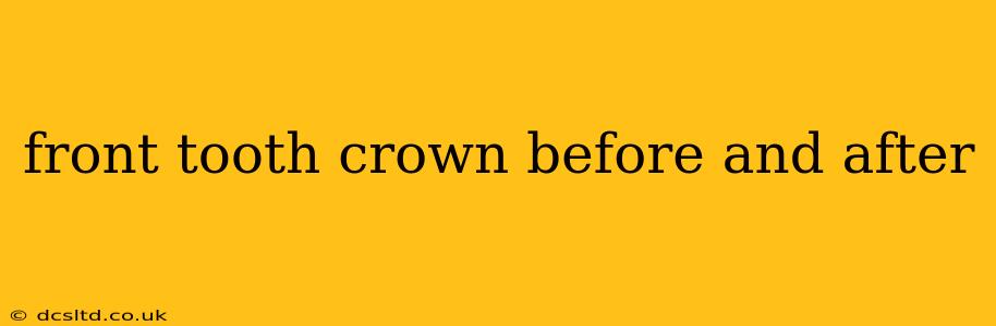 front tooth crown before and after