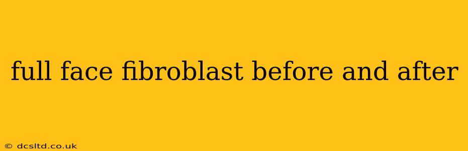 full face fibroblast before and after