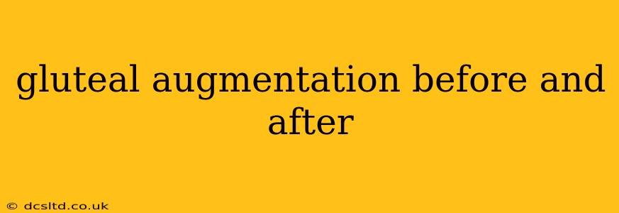 gluteal augmentation before and after