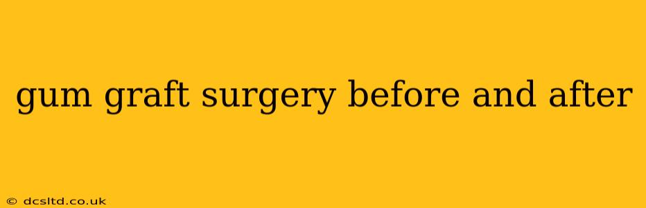 gum graft surgery before and after
