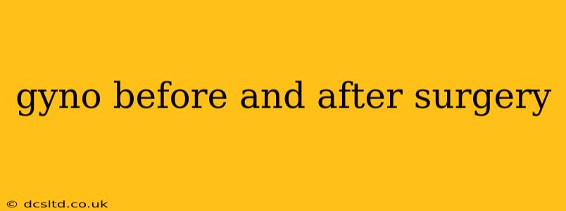 gyno before and after surgery