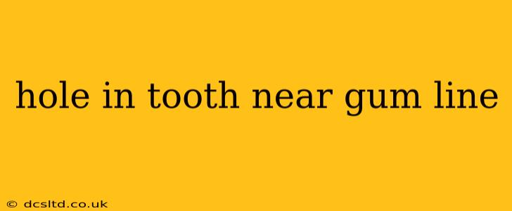 hole in tooth near gum line