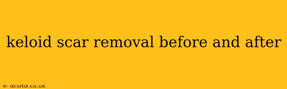 keloid scar removal before and after