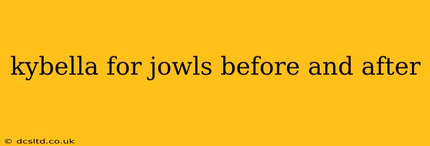 kybella for jowls before and after