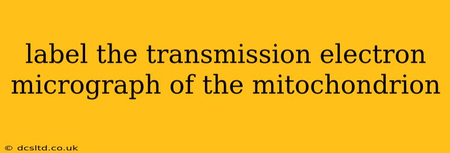 label the transmission electron micrograph of the mitochondrion