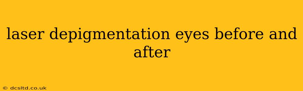laser depigmentation eyes before and after