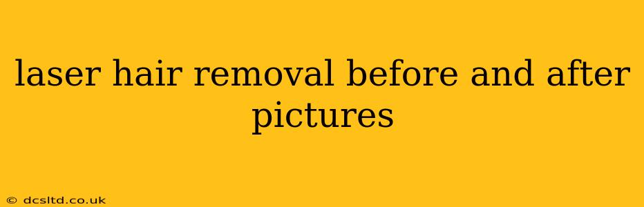 laser hair removal before and after pictures