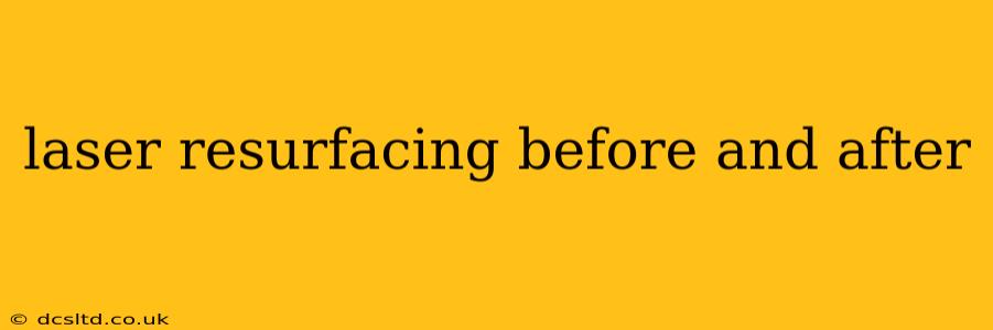 laser resurfacing before and after