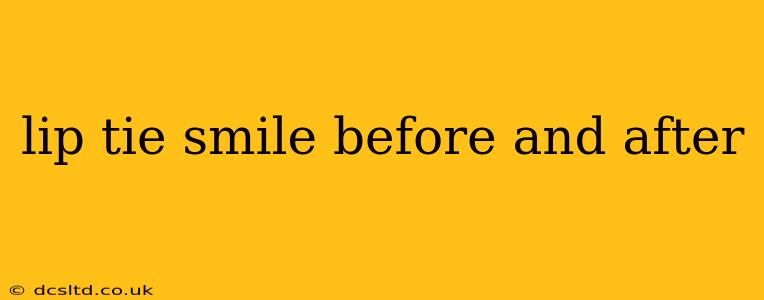 lip tie smile before and after