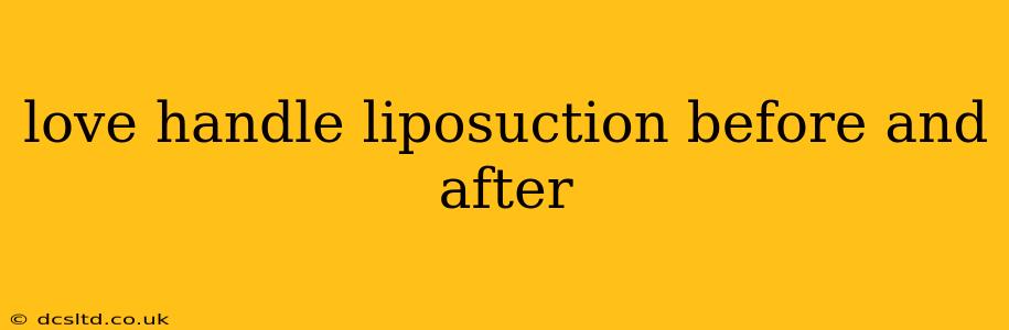 love handle liposuction before and after
