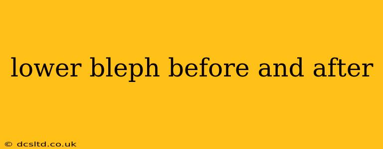 lower bleph before and after