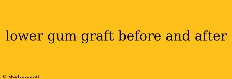 lower gum graft before and after